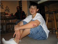 Stuart's scary elbow